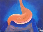 “Helicobacter pylori: la historia de una bacteria”