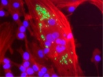 Descubriendo los secretos de la enfermedad de Chagas