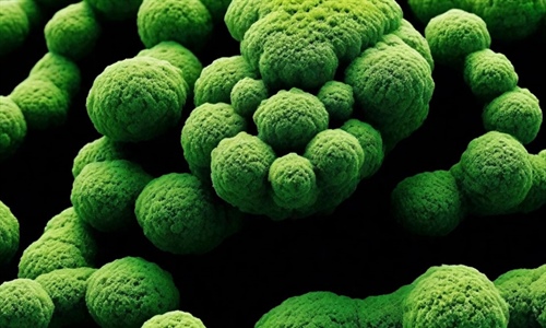 Papel fisiológico de Azotobacter nigricans en la aplicación de un...