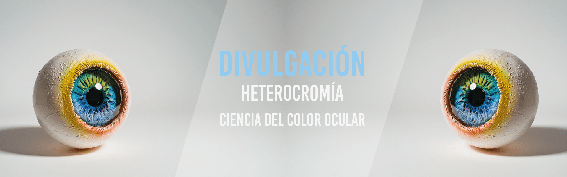 Heterocromía