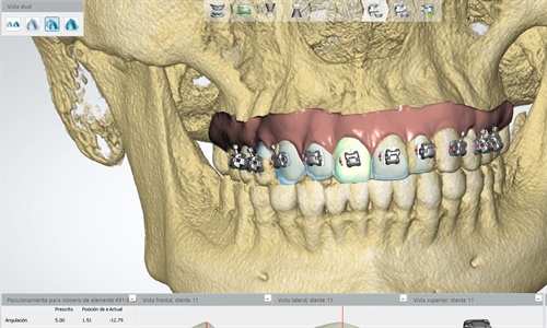 Ortodoncia digital: viviendo el futuro